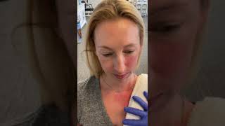 Platysma Exercise part 4