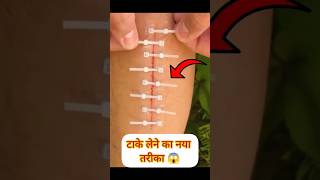 Zip Stitch #shorts#healthtips #nurse #nursing #medical #hospital#youtubeshorts#doctor #emergencycare