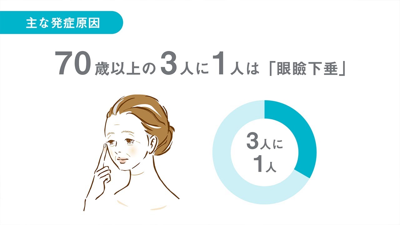 眼瞼下垂 がんけんかすい かつむらアイプラストクリニック 浦和