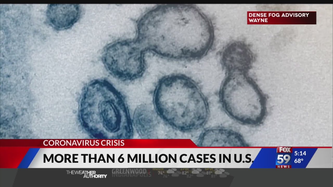 U.S. coronavirus cases surpass 6 million