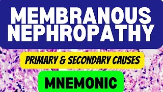 Membranous Nephropathy: Types, Causes, and Mnemonics | Nephrotic Syndrome | Glomerulonephritis