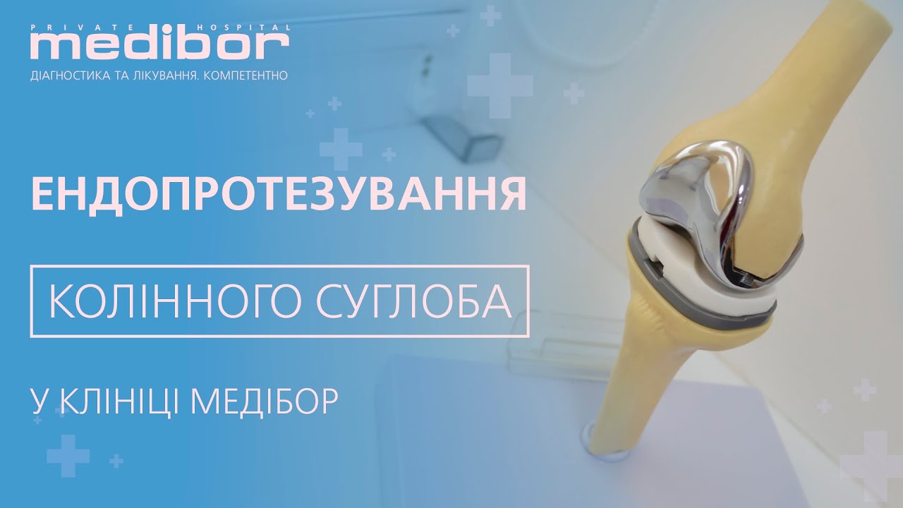 Підвивих колінного суглоба. Коксартроз: степени, симптомы, причины и диагностика Травма колінного суглоба Статья про Что такое гонартроз колена с аудио подкастом