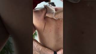 Where does that finger go?? Scapular Release!