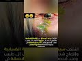 مسنة في عينها 23 عدسة لاصقة