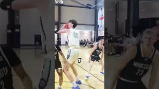 79 Oliver Rioux Is The Tallest Teen In The World