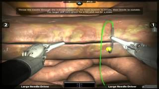 Innovation in Suturing