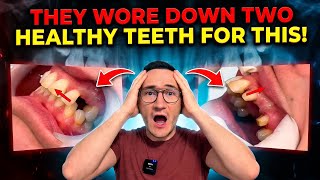 They wore down 2 healthy teeth for this! Zirconium Dental bridge