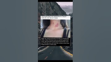 Dealing with Unwanted Attention: A Humorous Take#comedy #relationshiphumor #funny