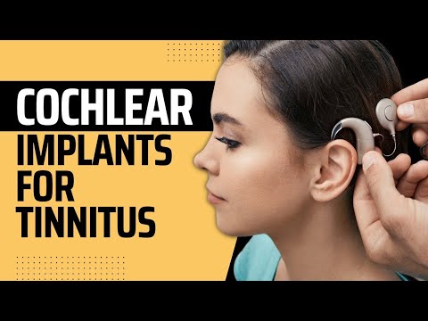 Video: Vyliečia kochleárne implantáty tinnitus?