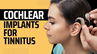 Understanding Cochlear Implants for Tinnitus Relief