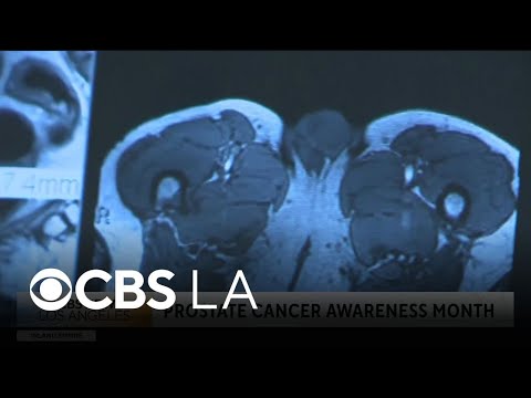 Doctor discusses prostate awareness, symptoms and signs