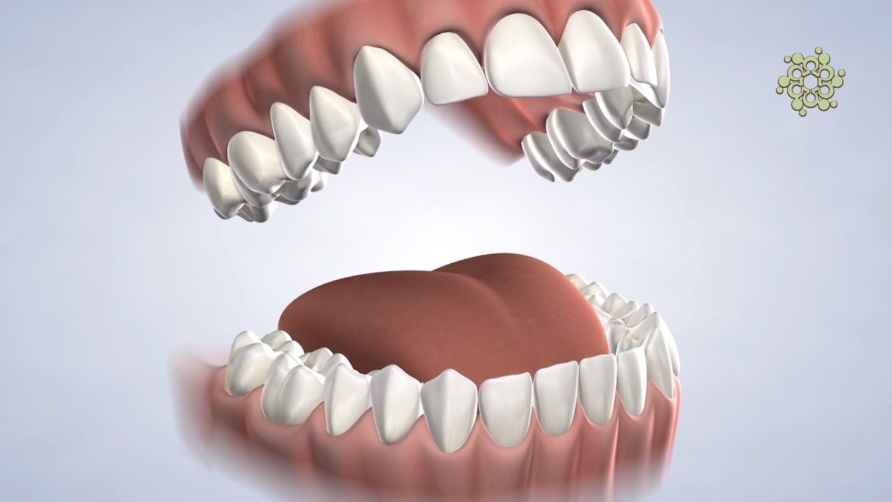 Instrucciones Postoperatorias at Beacon Oral & Maxillofacial Surgeons