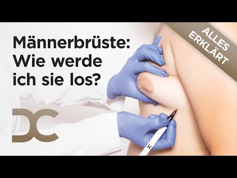 Video: Wie Man Brüste Bei Männern Verkleinert