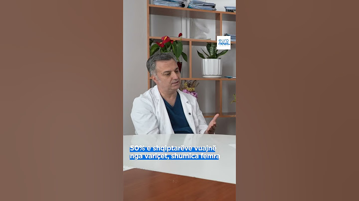 50% e shqiptarëve vuajnë nga variçet, shumica femra
