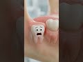 Don't ignore your wisdom tooth 🦷🤥 #bds #dentistry #wisdom #pwmededbds