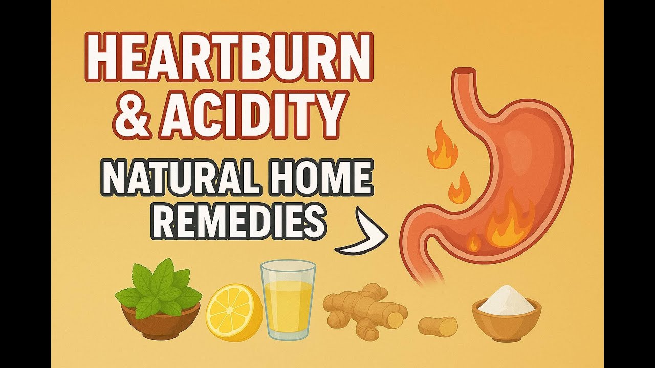 GERD/ Acidity/ Heart burn/ Chest burn/ Home remedies/ treatment/ English