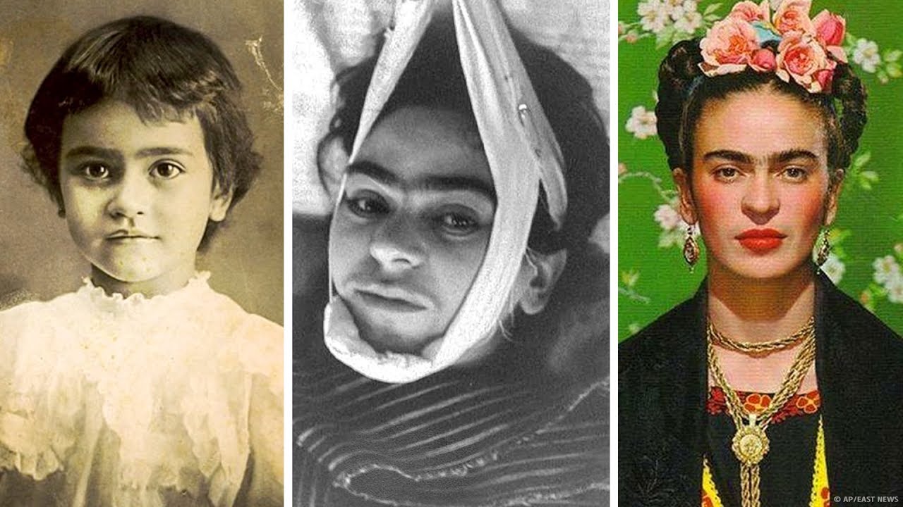 Frida Kahlo'nun Trajik Hikayesi - YouTube