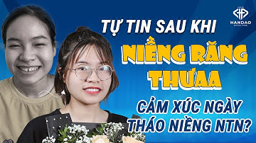 Niềng răng thưa | cảm xúc sau tháo niềng răng?
