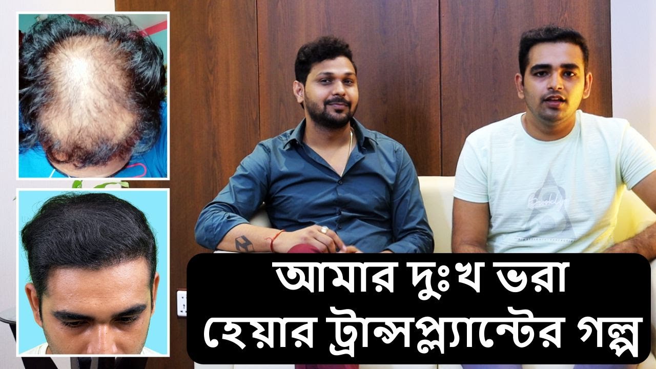Hair Transplant correction Surgery In Bangladesh ! YouTube