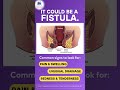 Experiencing persistent discomfort or pain? It could be a sign of a fistula! | Arogyam piles Clinic