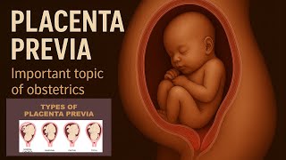 Placenta Previa Animated | Easy Explanation with Diagram l Intro ,causes, types, treatment 