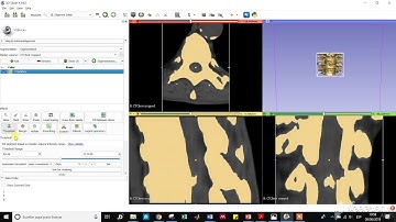 Cómo segmentar una vértebra utilizando 3DSlicer