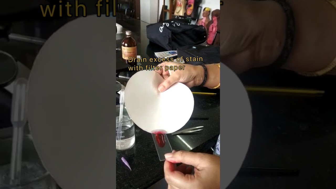 Class X Subject Biology Experiment To Prepare Temporary Mount Of Leaf class-x-subject-biology-experiment-to-prepare-temporary-mount-of-leaf