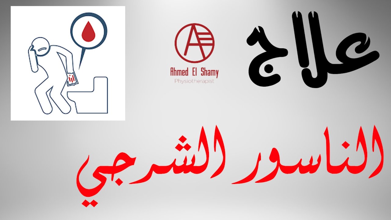 أفضل تمارين لعلاج الناسور الشرجي | أعراض وأسباب الناسور الشرجي | Anal Fistula 💢