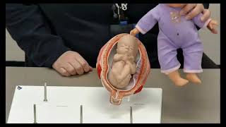 Fetal Lies and Presentations Profile