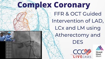 FFR & OCT Guided Intervention of LAD, LCx & LM using Atherectomy & DES -CCCLiveCase Dec 2013 Webcast