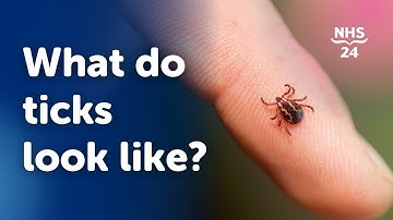 What do ticks look like?