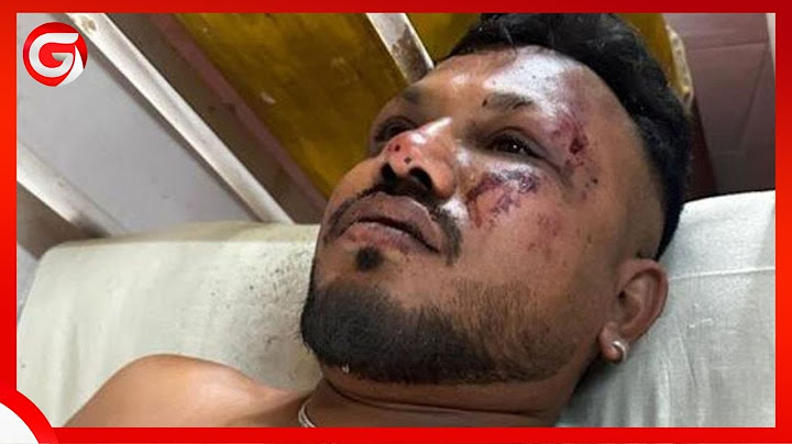 MIUJIZA! ABIRIA HUYU ALIVYOOKOKA AJALI ya NDEGE ILIYOUA WATU 200+ AFUNGUKA BAADA ya KUOKOLEWA...