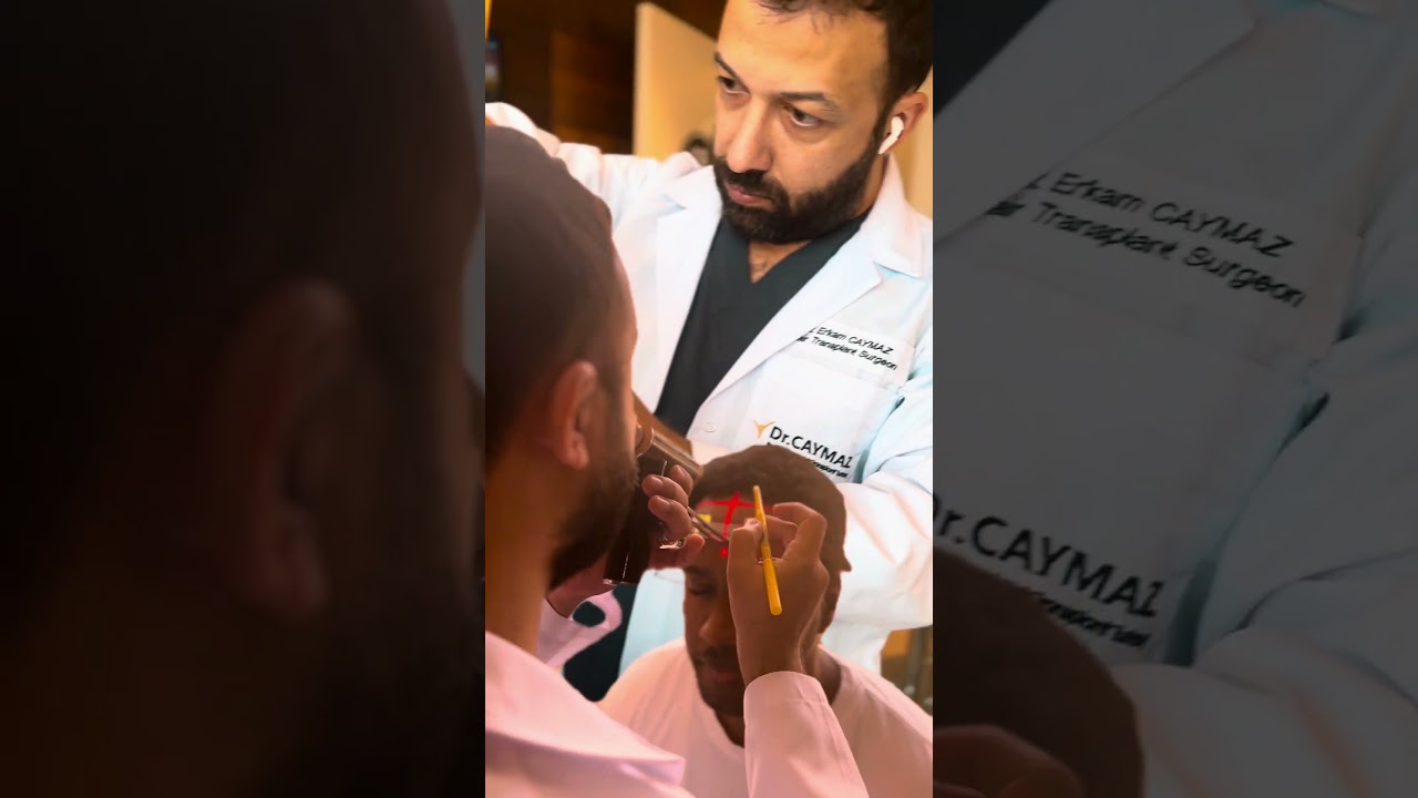 Hair Transplant Doctor #hairtransplant #hairimplant