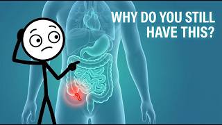 Why Do Humans Still Have an Appendix