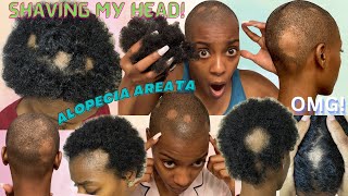 I SHAVED MY HEAD! Shaving All My Hair Off, Alopecia Areata, Hair Loss Journey 2023