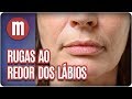 Rugas ao redor dos lábios - Mulheres (24/05/17)