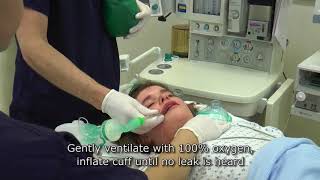 Paediatric Anaesthetics: Chapter 3 - Intubation rsi child