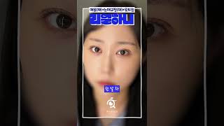 하니성형외과 리얼한 눈 수술 후기 (매몰+눈매교정+윗트임)  #shorts