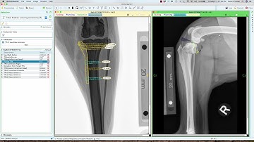 TPLO planning using OrthoView Vet two dimensional orthopedic planning software