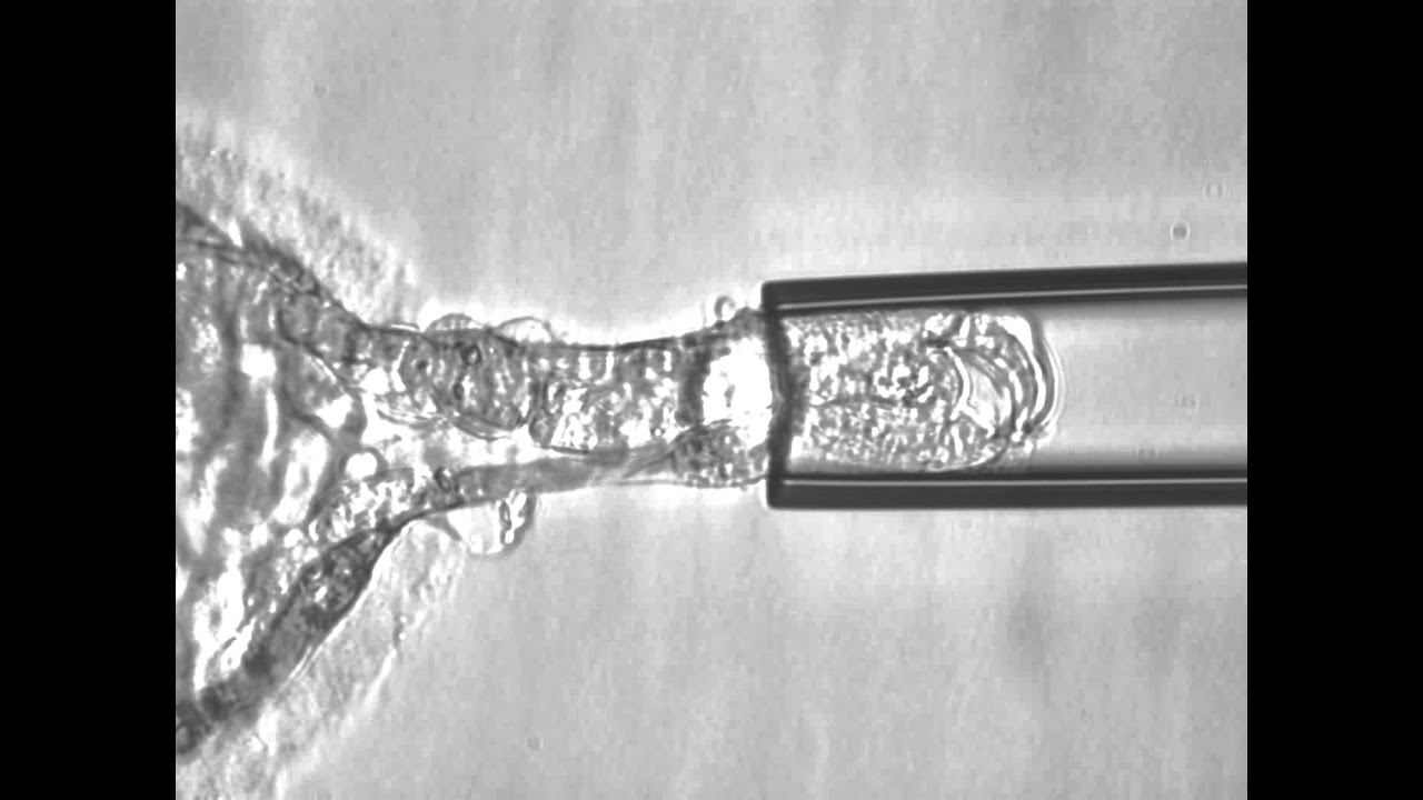 Trophectoderm Biopsy of Human Embryo - YouTube