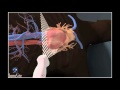 How to apical 4chamber view echocardiography 3d