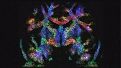 Mapping the unborn baby