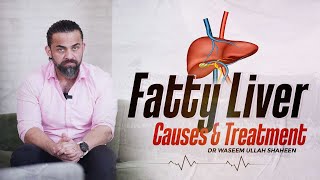 Fatty Liver | Causes & Treatment | Explained in Urdu/Hindi | Dr Waseem