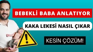 Bebek Kaka Lekesi Nasıl Çıkar? Kesi̇n Çözüm Uygulamalı Ve Sonuçlu