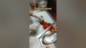 Cystic thyroid gland gross pathology
