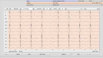 How to take an ECG directly from your patient file in Helix Practice Manager. (Best quality 1080 HD)