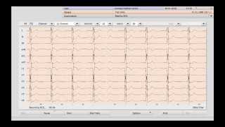 How to take an ECG directly from your patient file in Helix Practice Manager. (Best quality 1080 HD) screenshot 5