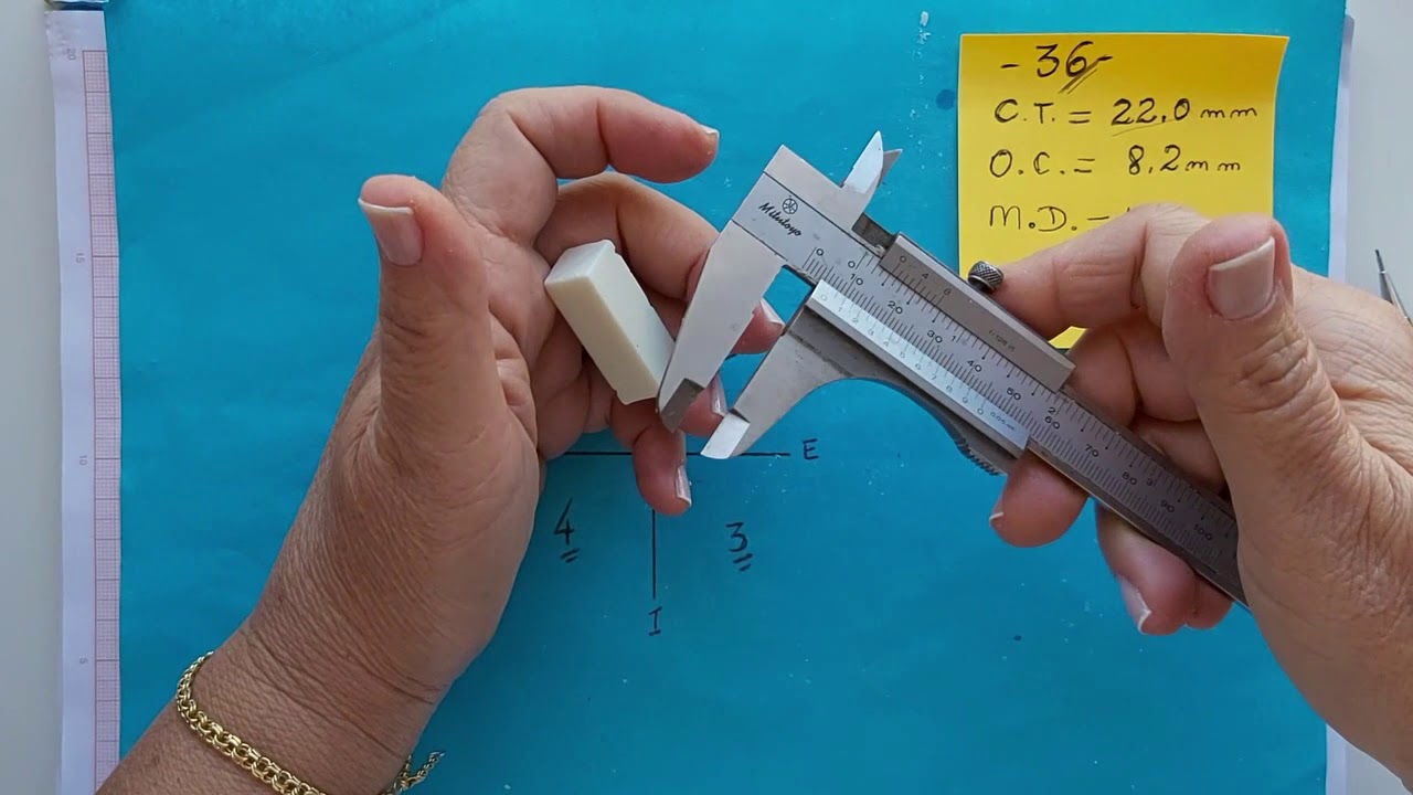 Escultura dos dentes 36 e 37