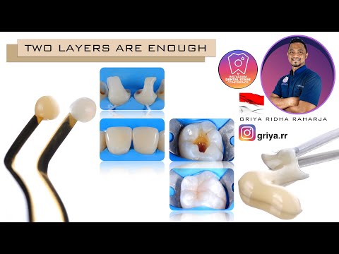 COMPOSITE WEBINAR TWO LAYERS ARE ENOUGH BY DR GRIYA RIDHA RAHARJA INDONESIA 