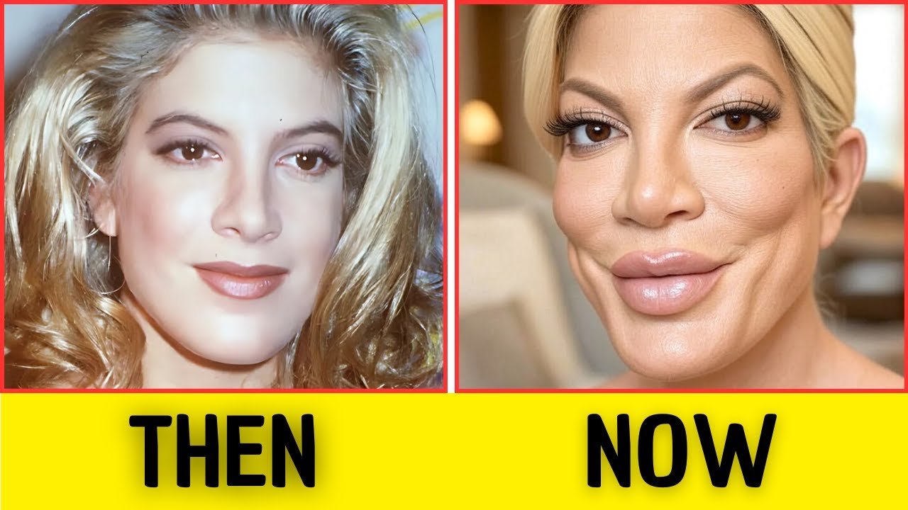 BEVERLY HILLS, 90210 CAST -  THEN AND NOW (SOME ARE GONE FOREVER..)